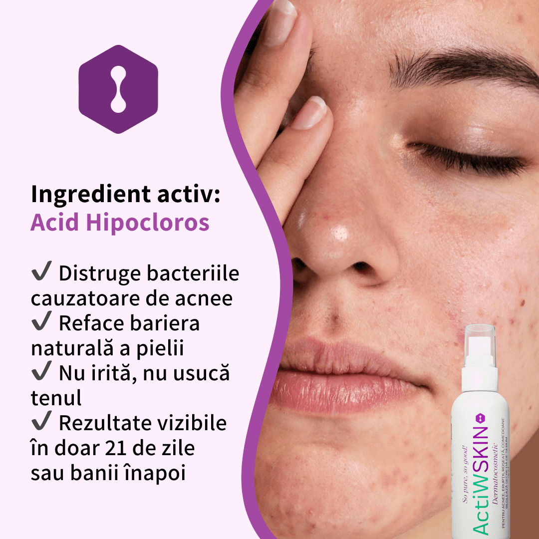 ActiW SKIN -PENTRU ACNEE - Pachet Complet - Tratament 42-50 de zile