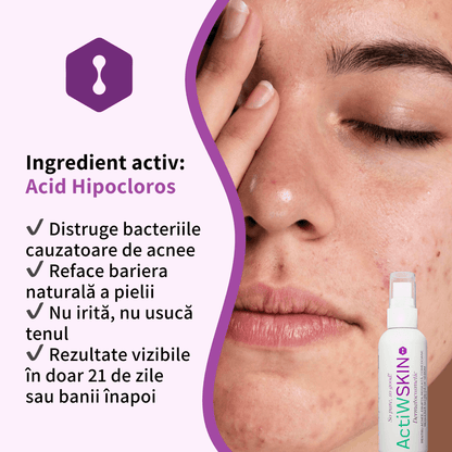 ActiW SKIN -PENTRU ACNEE - Pachet Complet - Tratament 42-50 de zile